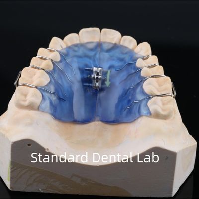 Parafusos de arco dental expansores de paladar expansores de dentes expansores de ortopedia removíveis