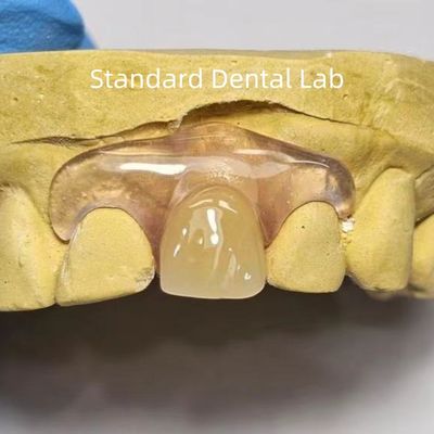 Dental TCS Valplast Dentes parciais flexíveis Dentaduras resistentes a odores desbotantes