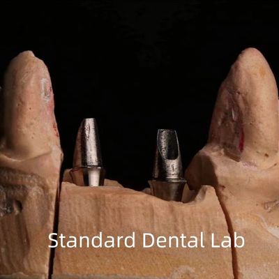 Porcelana Dental Circônio Implante Coroa Profissional Alta Estética