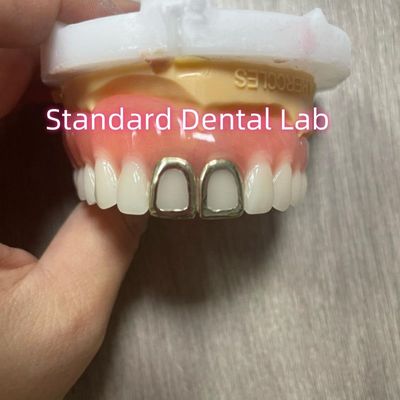 Dentes ISO Full Acrylic Dentures com Dentes de Ouro Amarelo Face Aberta
