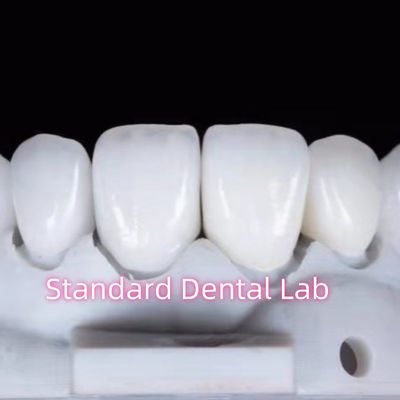 Restaurações de aparência natural Aidite Dental Zirconia Coroa dentária