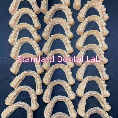 Dentista Profissional Dentes Ortodônticos Invisalign Retentores Claros Plano de Tratamento