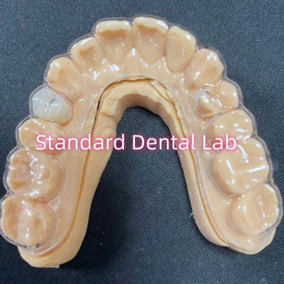 Retentor Ortodôntico Profissional Retentores Essix Claros Com Dentes de Resina Acrílica Estáveis