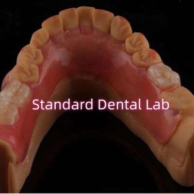 Alta estética flexível Valplast dentadura parcial fácil de limpar