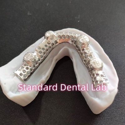 Quadro metálico de cobalto fundido Cromo Dentadura parcial com estrutura de metal