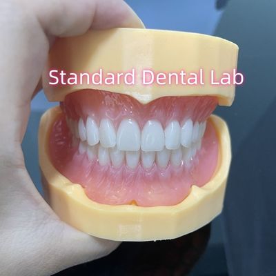 Dentes de alta estética Dentaduras acrílicas completas superiores e inferiores Dentes Ivoclares Goma rosa