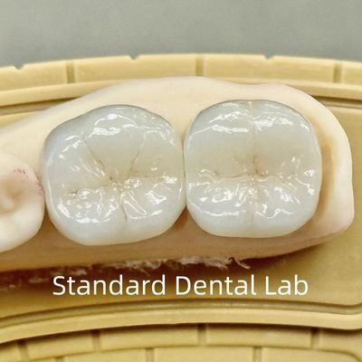 Coroas de laboratório dentário translúcidas de zircônio de contorno completo com resistência superior