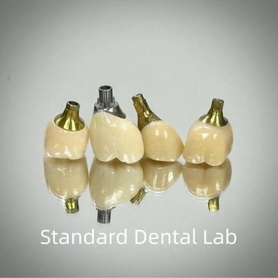 Profissional Zirconia parafuso Implante retido coroa de titânio CAD CAM