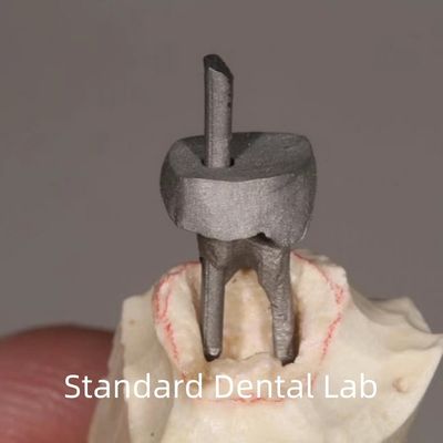 Restauração Dental Post Metal e Core Crown Perfeito Ajuste