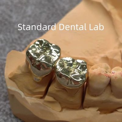 High Nobel Amarelo Dental Coroas de Ouro Profissional Ni Be Grátis ISO aprovado