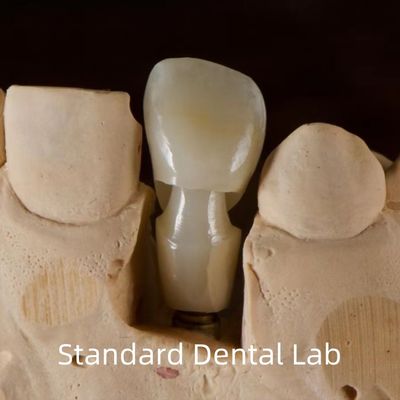 Implante Dental Tibase Zirconia Abutment Titânio Precisão personalizada