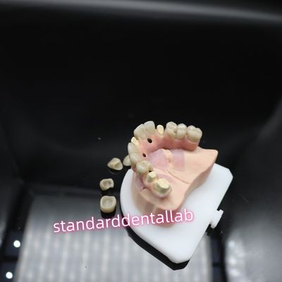 Ponte de Implante Dental Digital de Malo Titânio Ivoclar Ponte de Circônio Híbrido