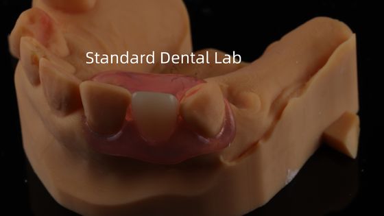 Dental TCS Valplast Flexíveis Dentes Parciais Nesbit Valplast Finish China Dental Lab Valplast Clamps