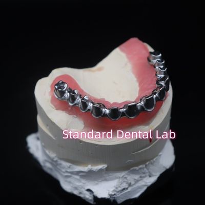 Full Arch Malo Bridge Restauração Dental Coroas de zircônio com goma Poecelian China Dental Lab