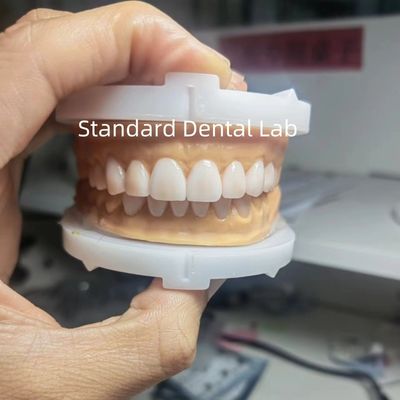 Perfeita Estética Cera Provisória para Dentistas Profissionais Usando Cera Dental do Laboratório Dental da China
