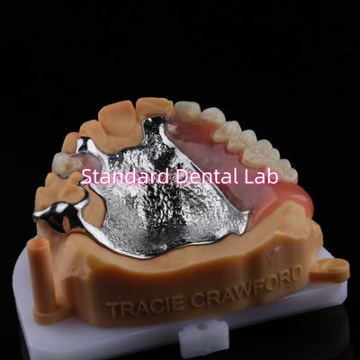 Quadro superior fundido Dentes parciais de metal acrílico Forte leve e durável