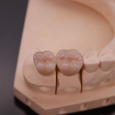 Confortável coroa de zircônio com acabamento estético preciso Express 3-4 dias Tempo de entrega