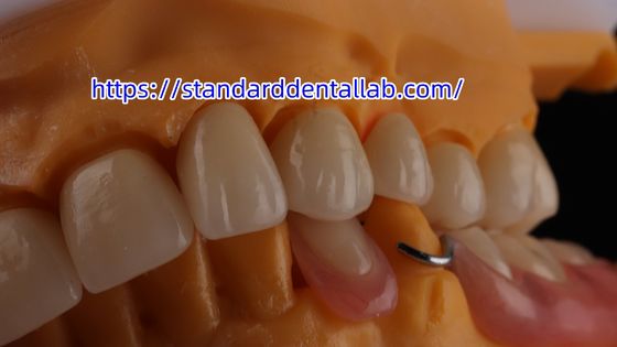 Coroa Dentária de Zircônia em camadas e ponte Translucidez 3D PRO coroa de porcelana de zircônia