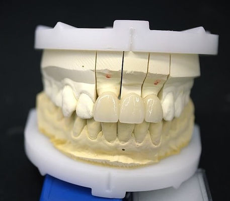 Ponte de coroa de zircônio de precisão confortável / estética 3-4 dias Tempo de entrega rápido