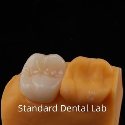Garantia de 5 anos coroa de zircônio de contorno completo para dentes molares porcelana Noritake feita por laboratório dentário confiável