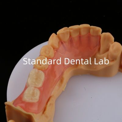 Ace Teeth Rosa/escura TCS Valplast Dentes parciais flexíveis para alta estética Dental 3D Print Model