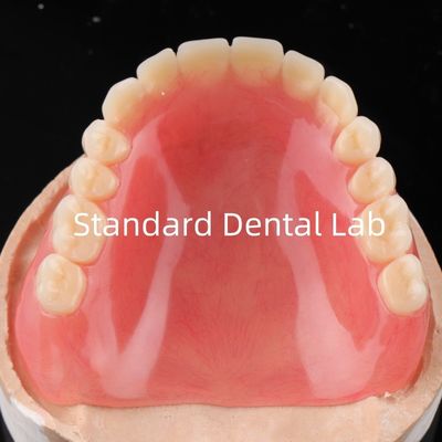 Prótese dentária acrílica completa resina acrílica para próteses dentárias acrílica completa China Dental Lab