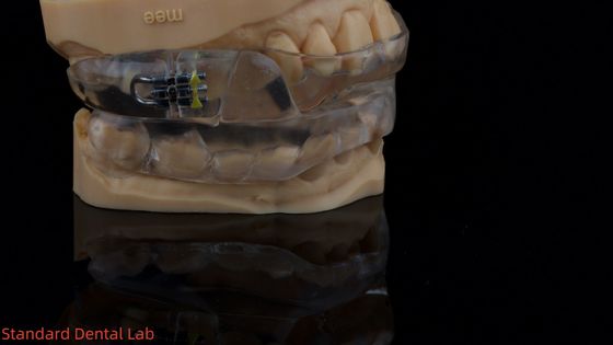 Dispositivo de sono dorsal personalizável Dispositivo anti-ronco para sono tranquilo Laboratório dentário chinês