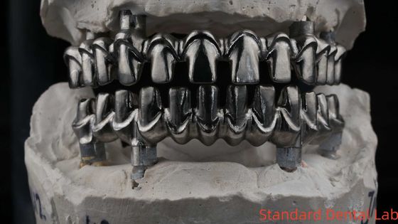 Dental Hybird Malo Implant Bridge Professional Perfect Fit Certificado pela FDA