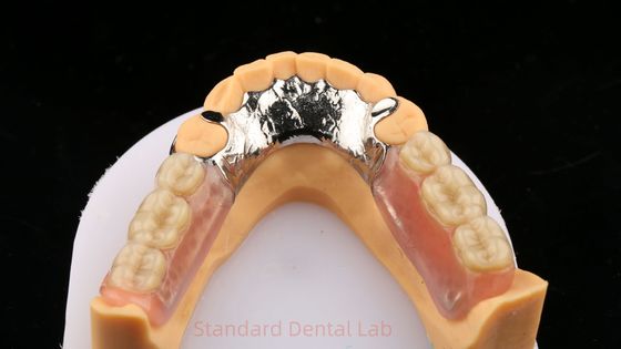 Ligações metálicas Cobalto Cromo Dentadura parcial Ivoclar Scheftner Confortável Quadro de Metal Fundido