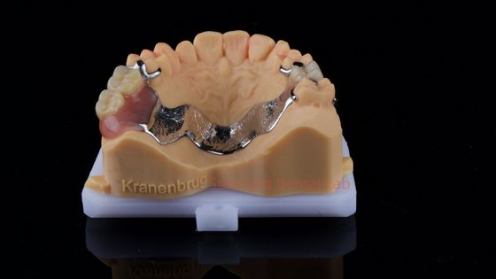 Dentes parciais de cobalto cromo Ivoclar Scheftner Confortável estrutura de metal entregue em apenas 3 dias