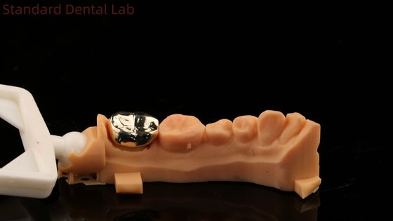 High Nobel Yellow Gold Crown Dent Professional Ni Be Free ISO e FDA aprovado China Dental Lab