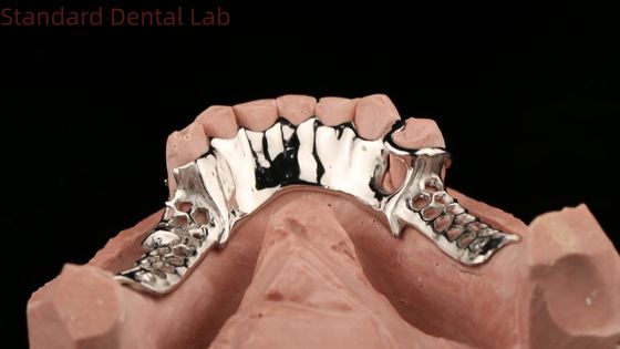 Cobalt Cromo Quadro de Metal Fundido Dentes Parciais Com Avental Inferior Design SDL Dental Lab