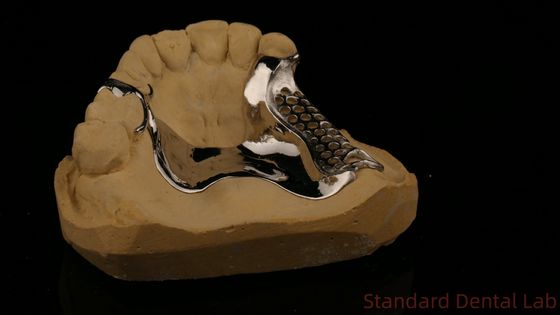 Estrutura de fundição impressa em 3D de alta resistência COCR Dentes parciais Cromo Cobalto Estrutura de metal fundido