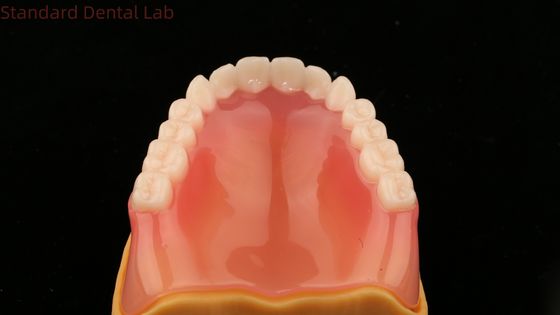 Dentes de Dentadura Completa Dentes de Dentadura Completa Ivoclar Dentes de Dentadura Completa Acrílico SDL Laboratório Dental