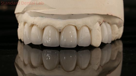 China Dental Lab Zirconia Full Contour Crown High Aesthetic Natural Dental Bridge 5 anos de garantia