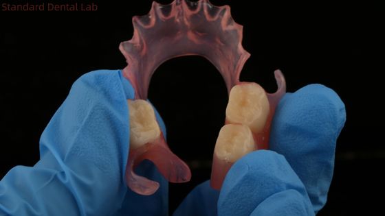 Dental TCS Valplast Flexíveis Dentes Parciais Nesbit Valplast Finish China Dental Lab Valplast Clamps