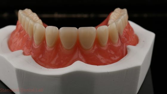Dentsply Lucitone 199 Dentadura acrílica para uma aparência natural