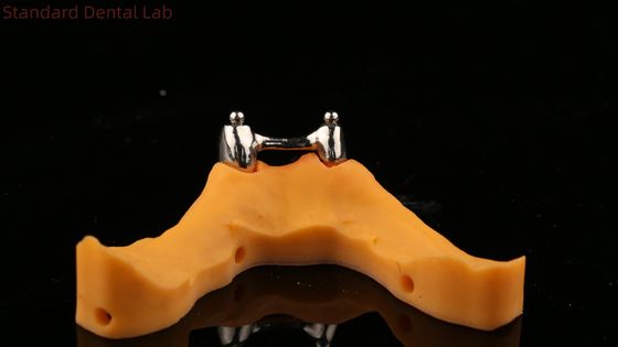 Dentaduras Ivoclar Digital Dental Implant Bar, Dentaduras de Titânio Acrílico Completo, Dentaduras de Implantos