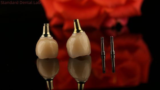 Implante de parafuso retido de cimento de zircônio de porcelana Forma de cabeça hexagonal para estética personalizada