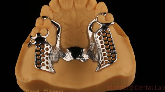 Ligações metálicas parcialmente Cobalt Cromo Dentes dentárias Ivoclar Scheftner Confortável China Dental Lab