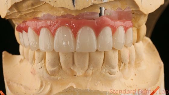Bom ajuste de precisão estética zircônio porcelana coroa rosa porcelana com sombra de branqueamento