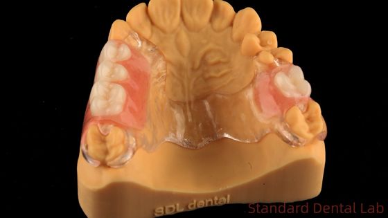 Estrutura de metal fundido transparente flexível Dentes parciais Alta estética Perfeito ajuste