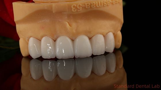 Full Contour Circonia coroa translúcida 3D PRO sem revestimento de porcelana