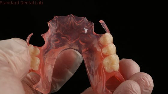 Ace Teeth Rosa/escura TCS Valplast Dentes parciais flexíveis para alta estética Dental 3D Print Model