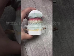 Profissional Alta Estética Porcelana Todos em 4 Implantes Dentários de Ponte de Circônio
