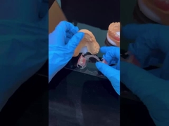 Quadro claro Acrílico Metal Quadros de Dentes Parciais Alta Estética Laboratório odontológico da China