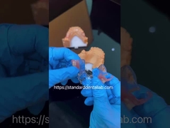 FDA Cobalto Cromo Estrutura clara de alta estética parcial