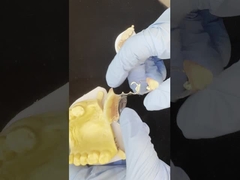 Quadro de fundição de cobalto cromo personalizável com adesivos muito bons