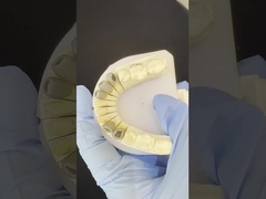 Metal fundido Post Core Crown Cocr Retentive Precise Full Zirconia Bruxier