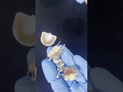 Quadro de fundição de cobalto cromo personalizável com adesivos muito bons